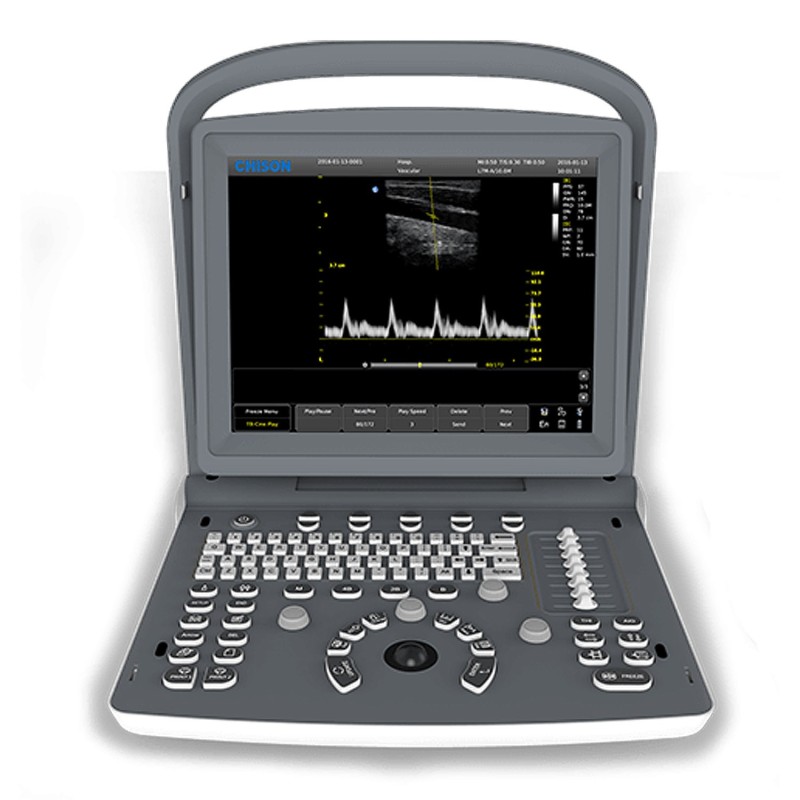 Ecógrafo portátil Chison ECO2 con sondas Ecógrafo portátil Chison ECO2 con sondas