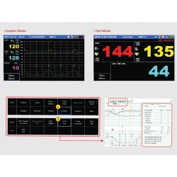 Bionet: Monitor Fetal  FC1400 | Quantum Spain