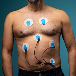 Electodos ECG Ambu BlueSensor VL larga monitorización conector snap o banana (500 uds)