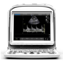 Ecógrafo veterinario portátil Chison ECO 3 EXPERT VET blanco y negro