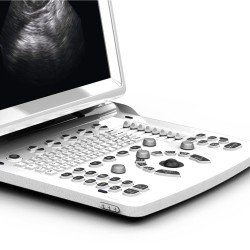 Ecógrafo veterinario portátil Chison ECO 3 EXPERT VET