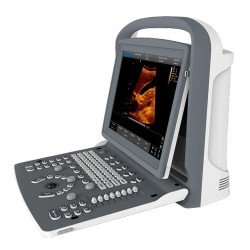 Ecógrafo veterinario portátil Chison ECO2 VET blanco y negro
