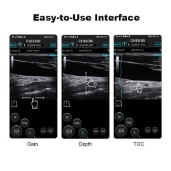 Ecográfo de mano SonoEye para smartphone/tablet | Quantum Spain