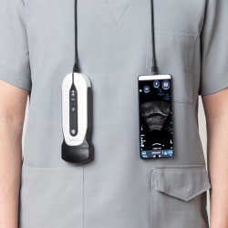 Ecográfo de mano SonoEye para smartphone/tablet | Quantum Spain