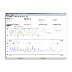 Software de pulsioximetría nVISION para palmsat