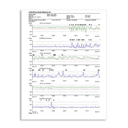 Software de pulsioximetría nVISION Nonin